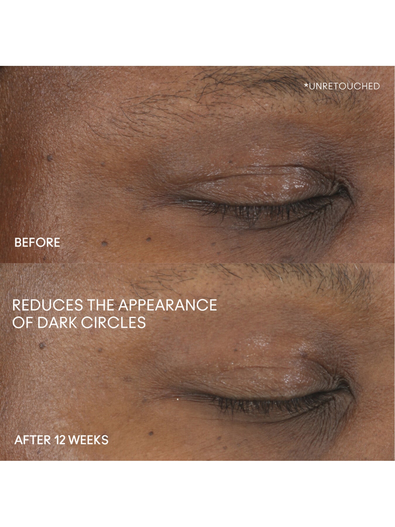 Hyper Real Serumizer Eye