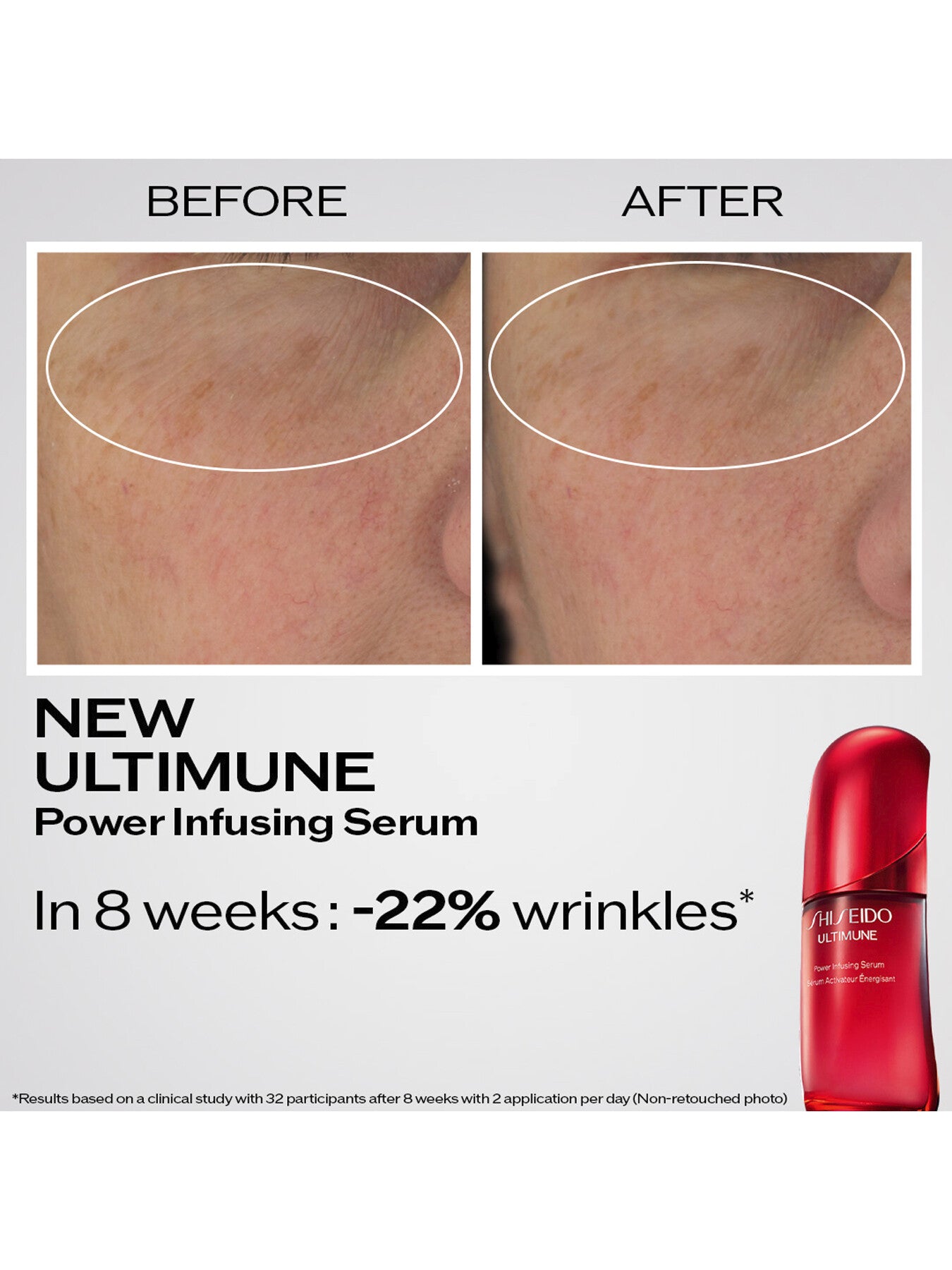 Ultimune Power Infusing Serum 50ml