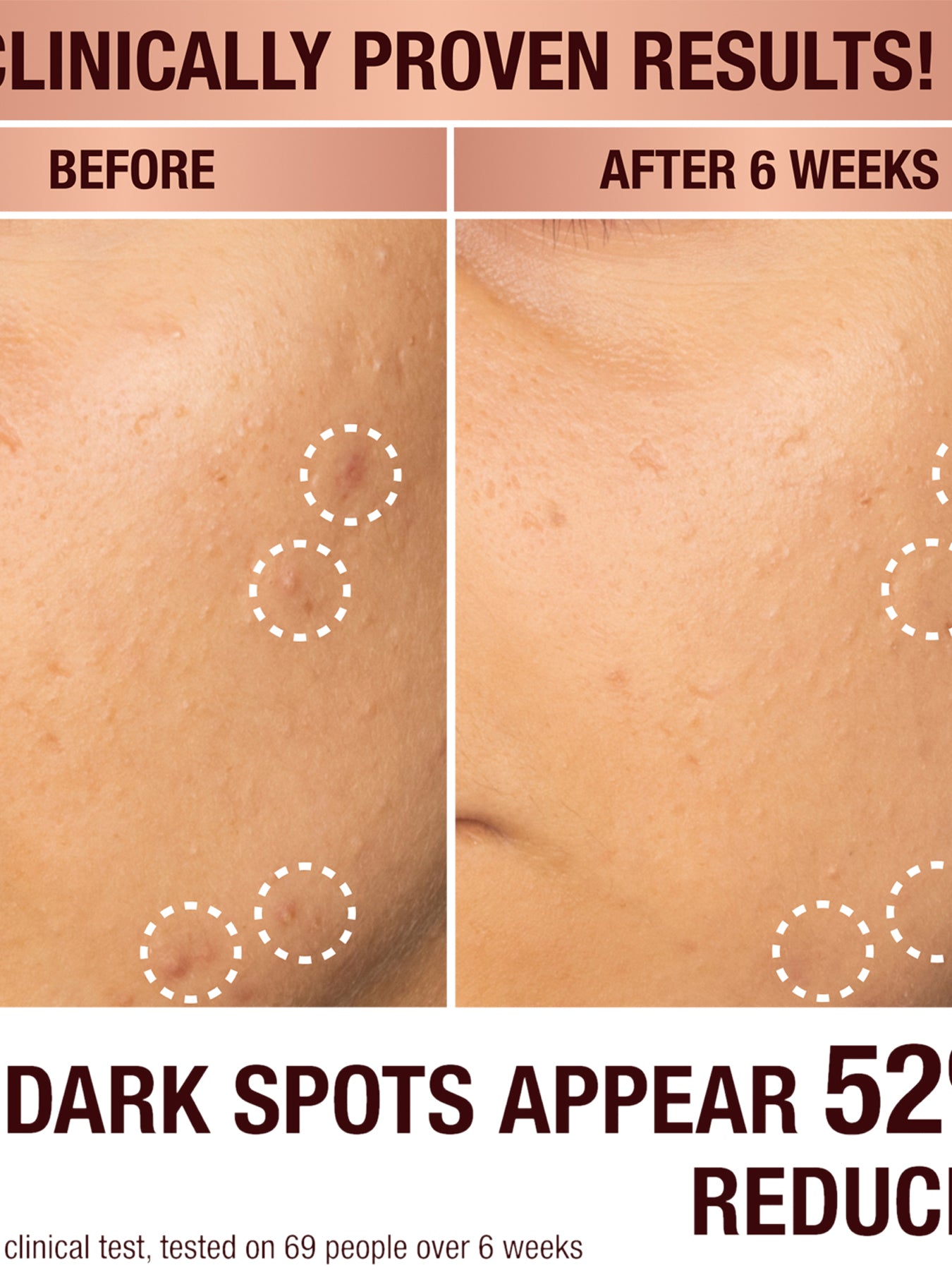 Dark Spot Correcting Radiance Recovery Serum 10ml