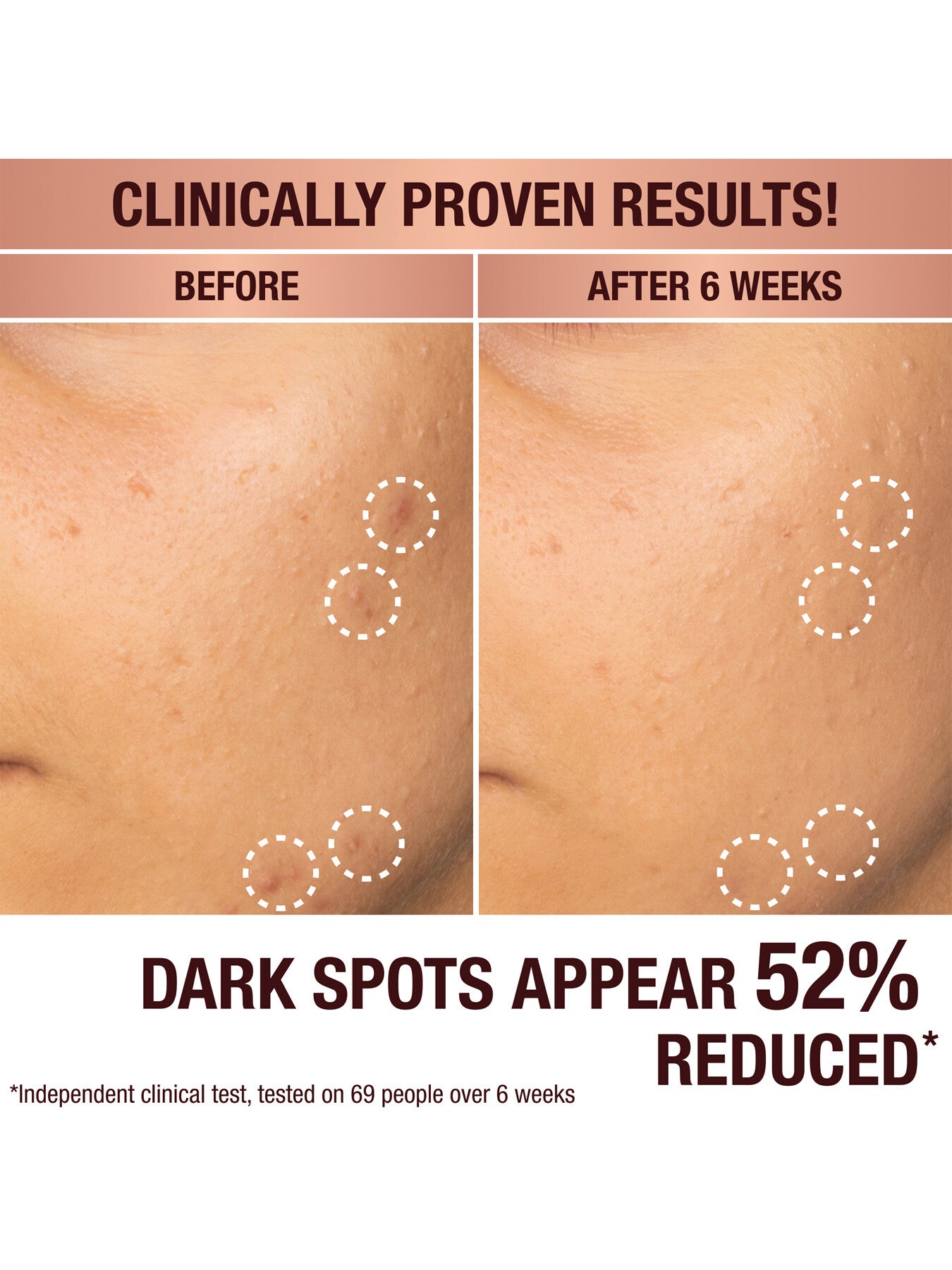 Dark Spot Correcting Radiance Recovery Serum 30ml
