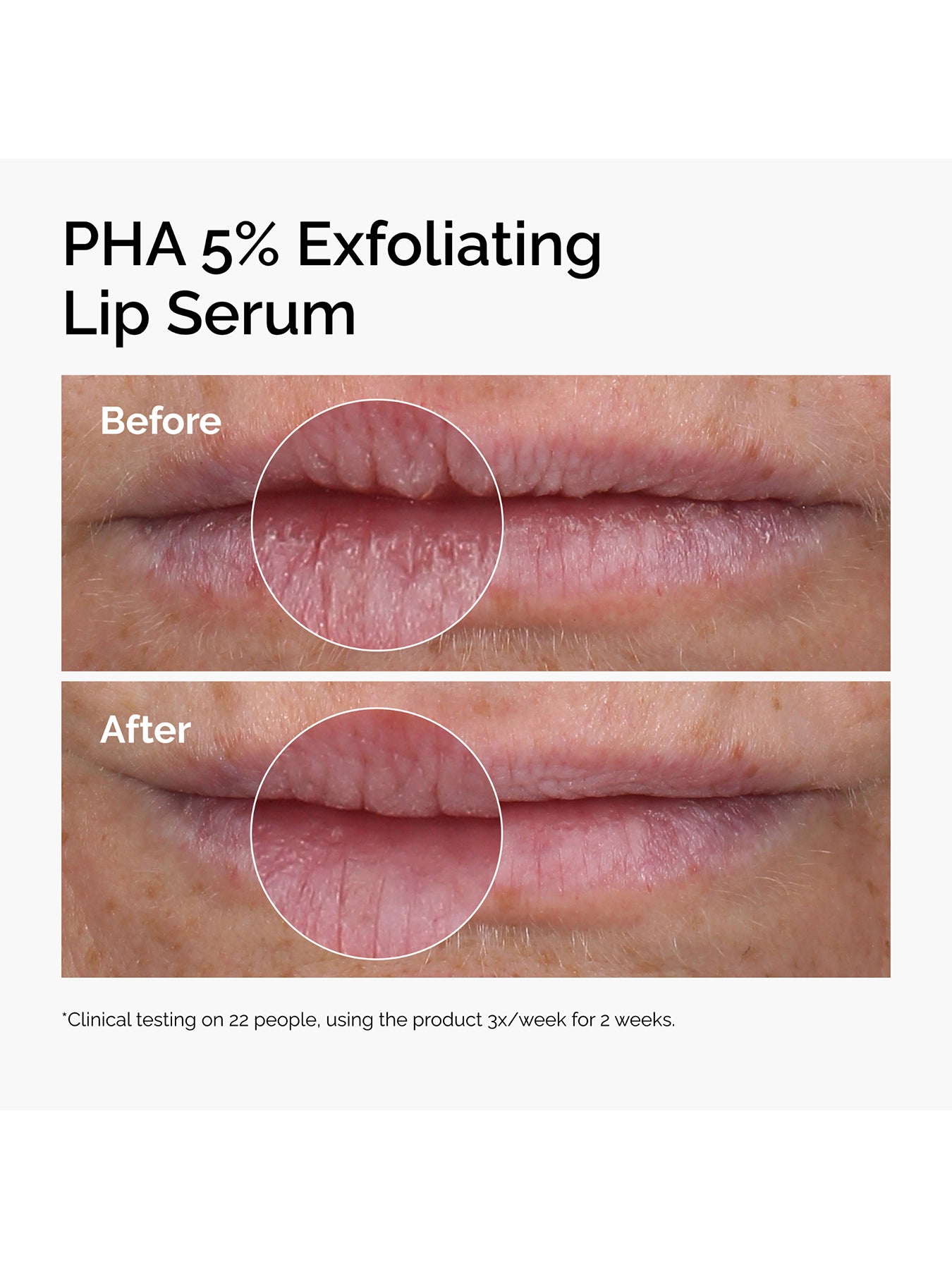 PHA 5% Exfoliating Lip Serum 15ml