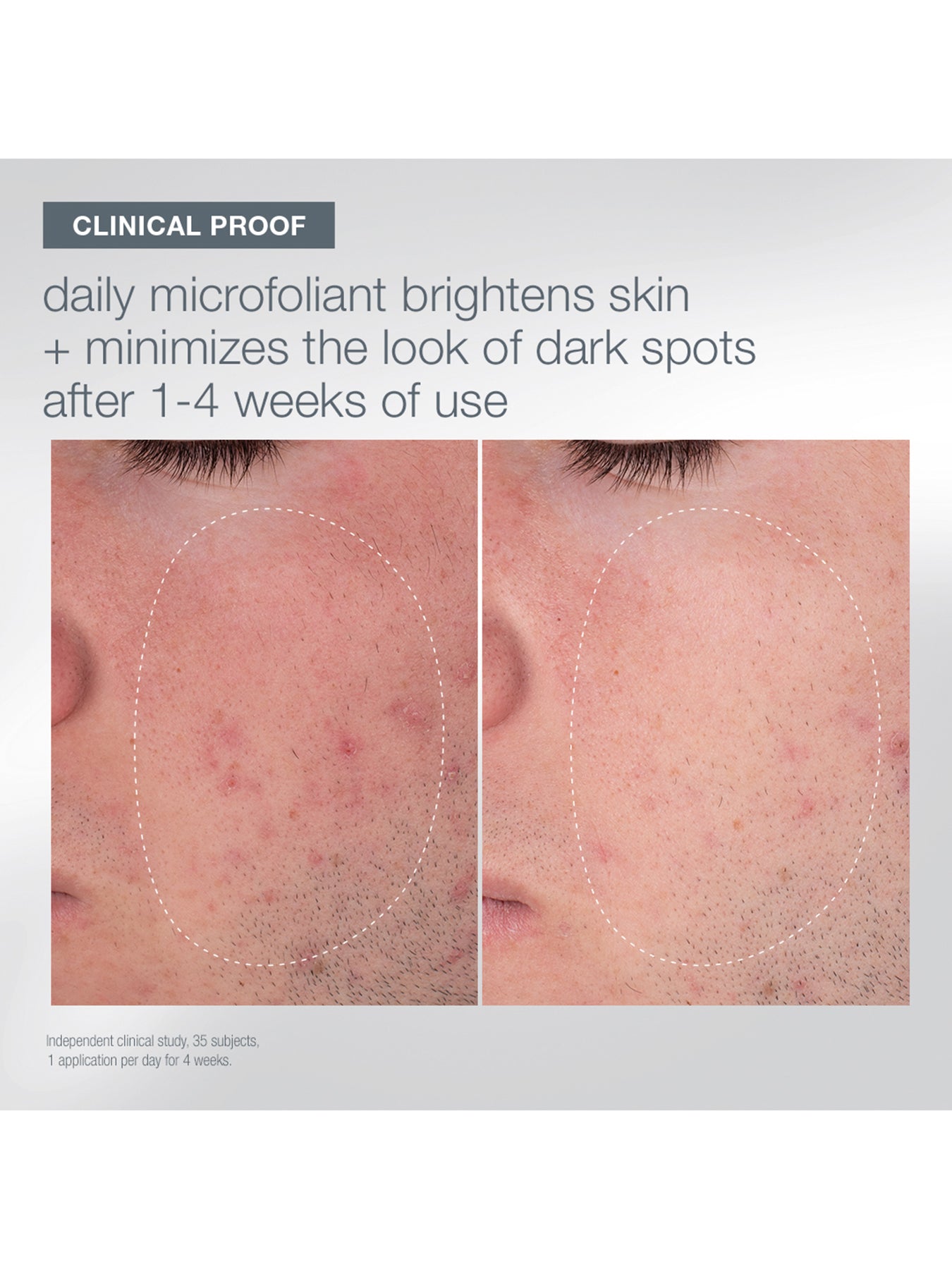 Home for the Holidays Skincare Set