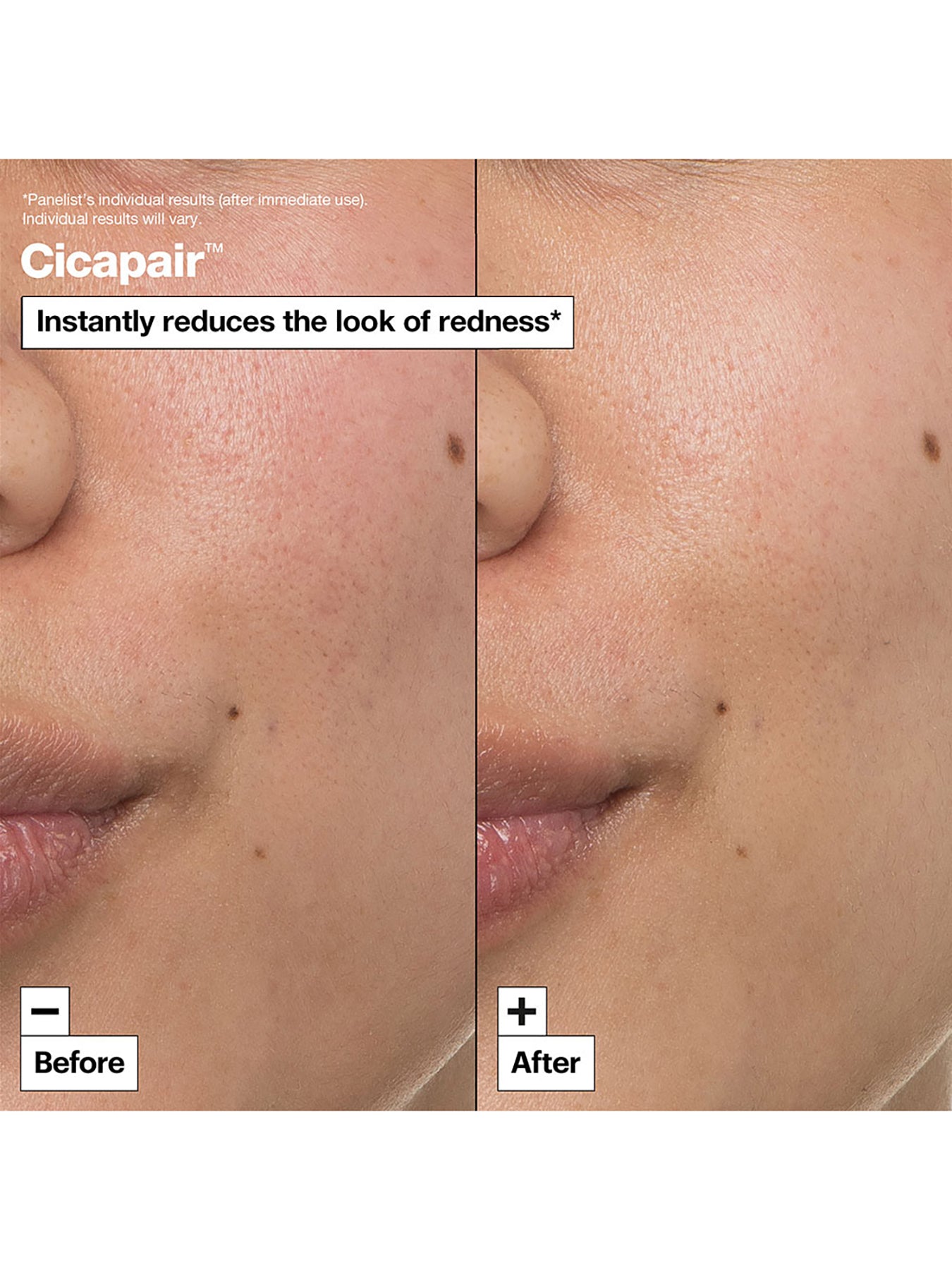 The Cicapair Intensive Soothing Repair Cream 50ml