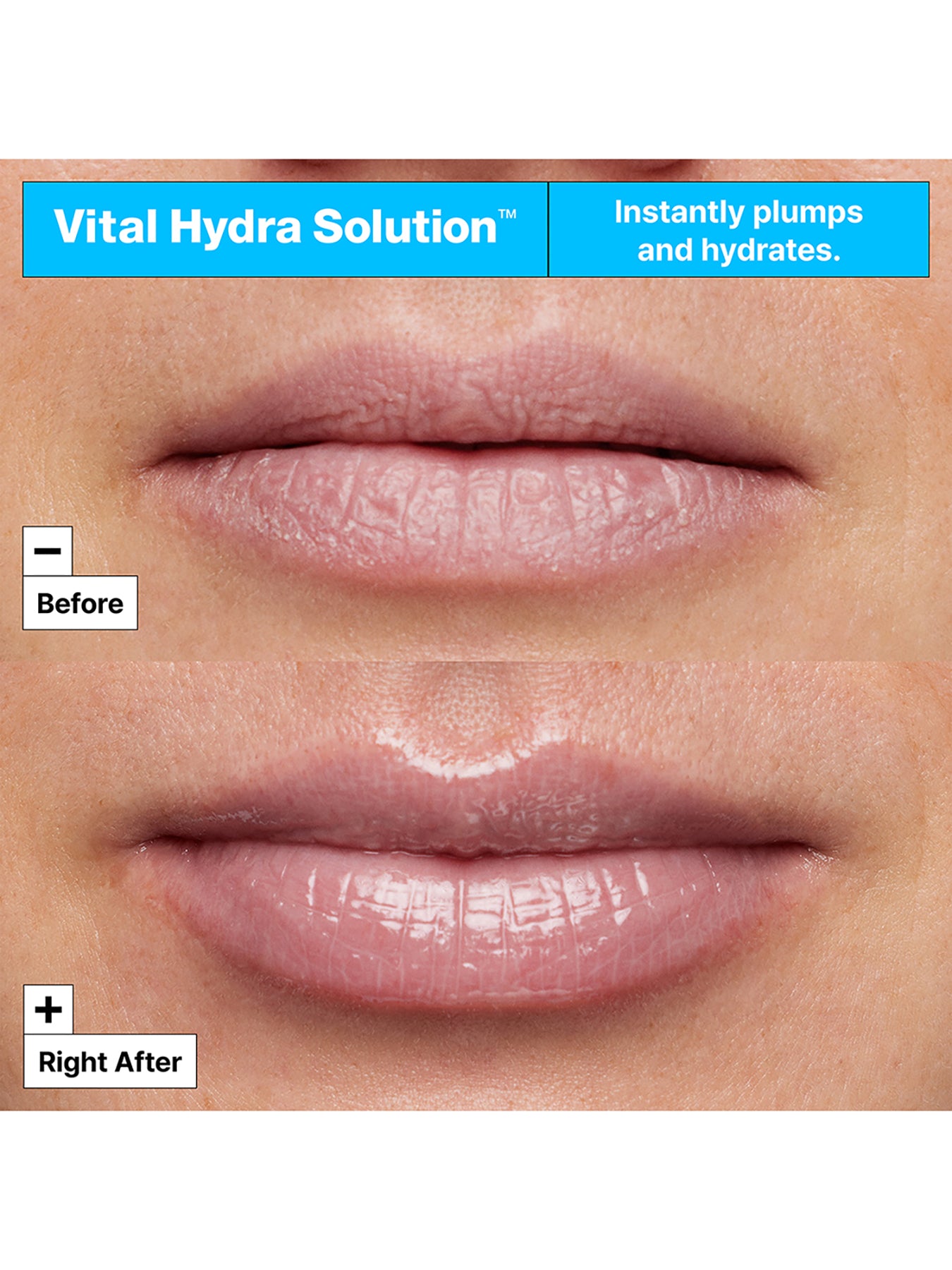 Vital Hydra Solution Lip Mask 20 ml