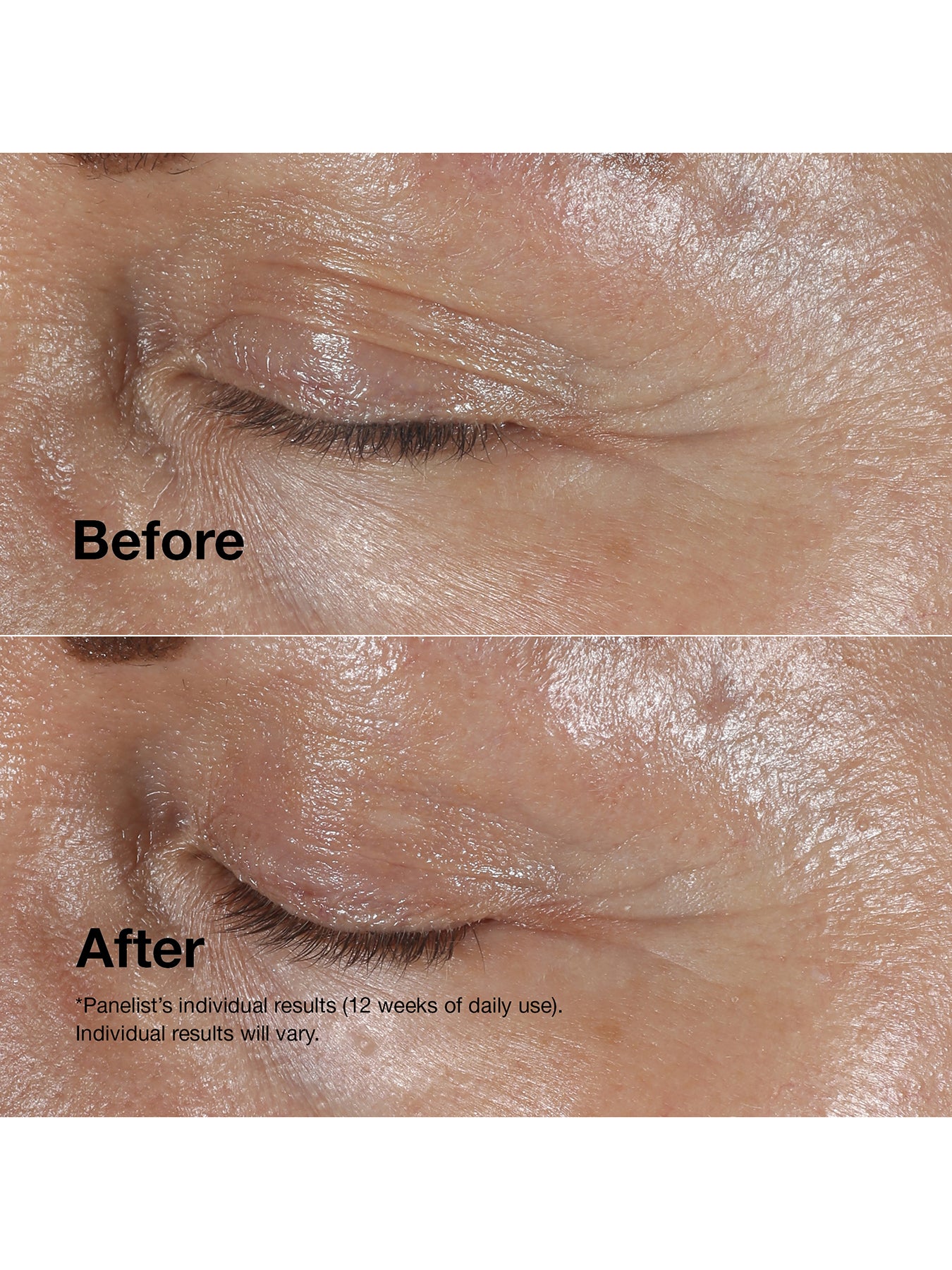 Clinique Smart Clinical Repair Anti-Aging Routine Mini Kit