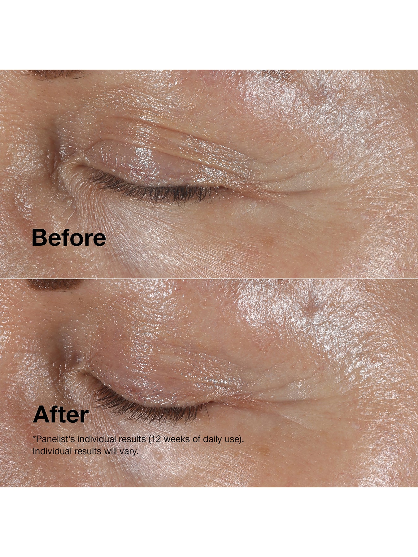 Smart Clinical Repair Lift And Smooth Routine Skincare Set
