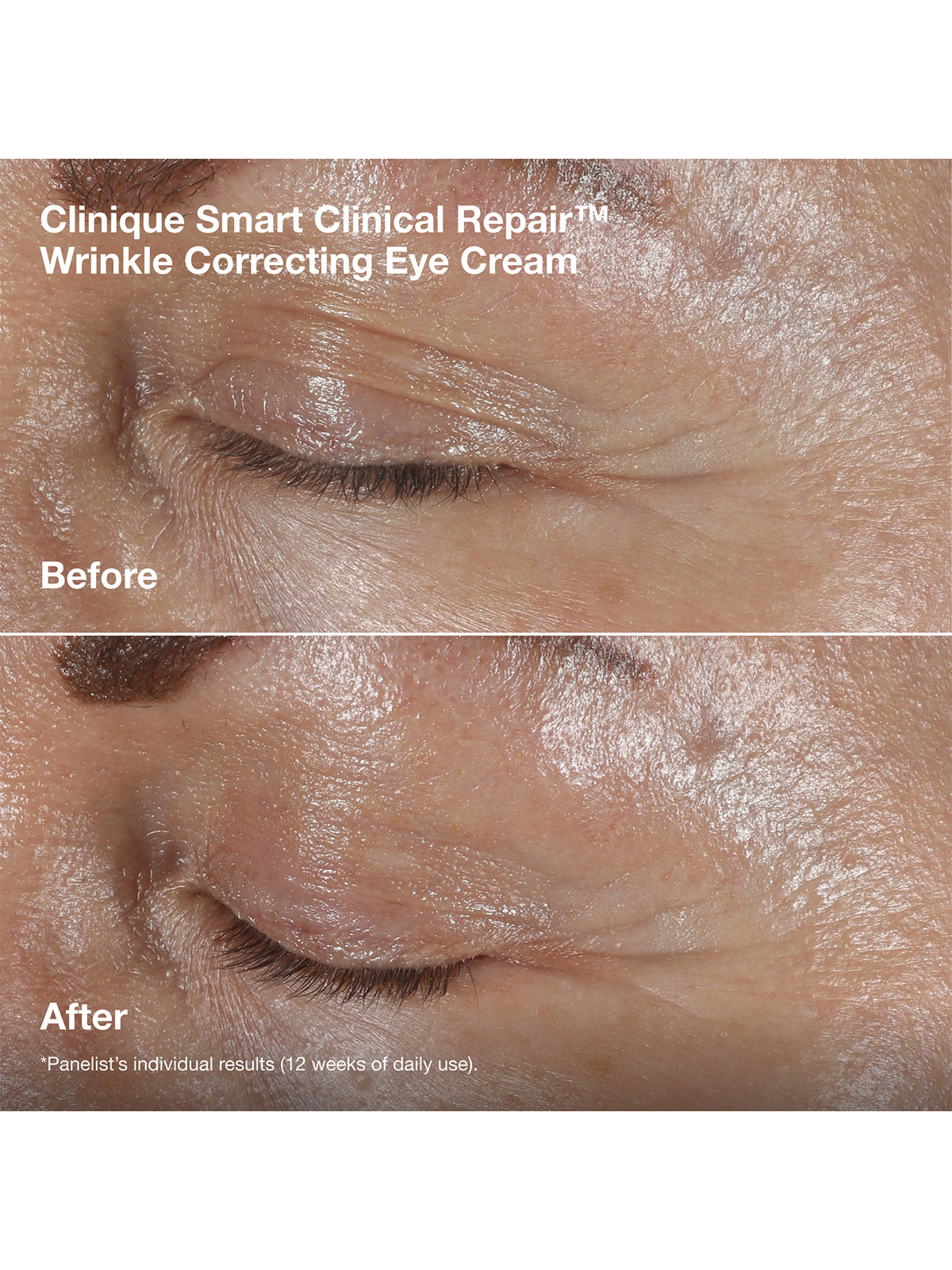 Smart Clinical Repair Wrinkle Correcting Cream Gift Set