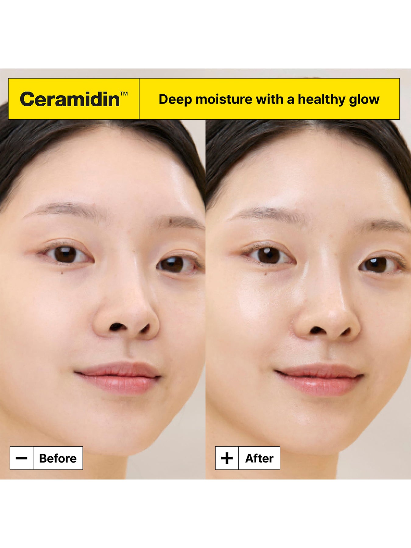 Ceramidin Skin Barrier Moisture Recovery Serum