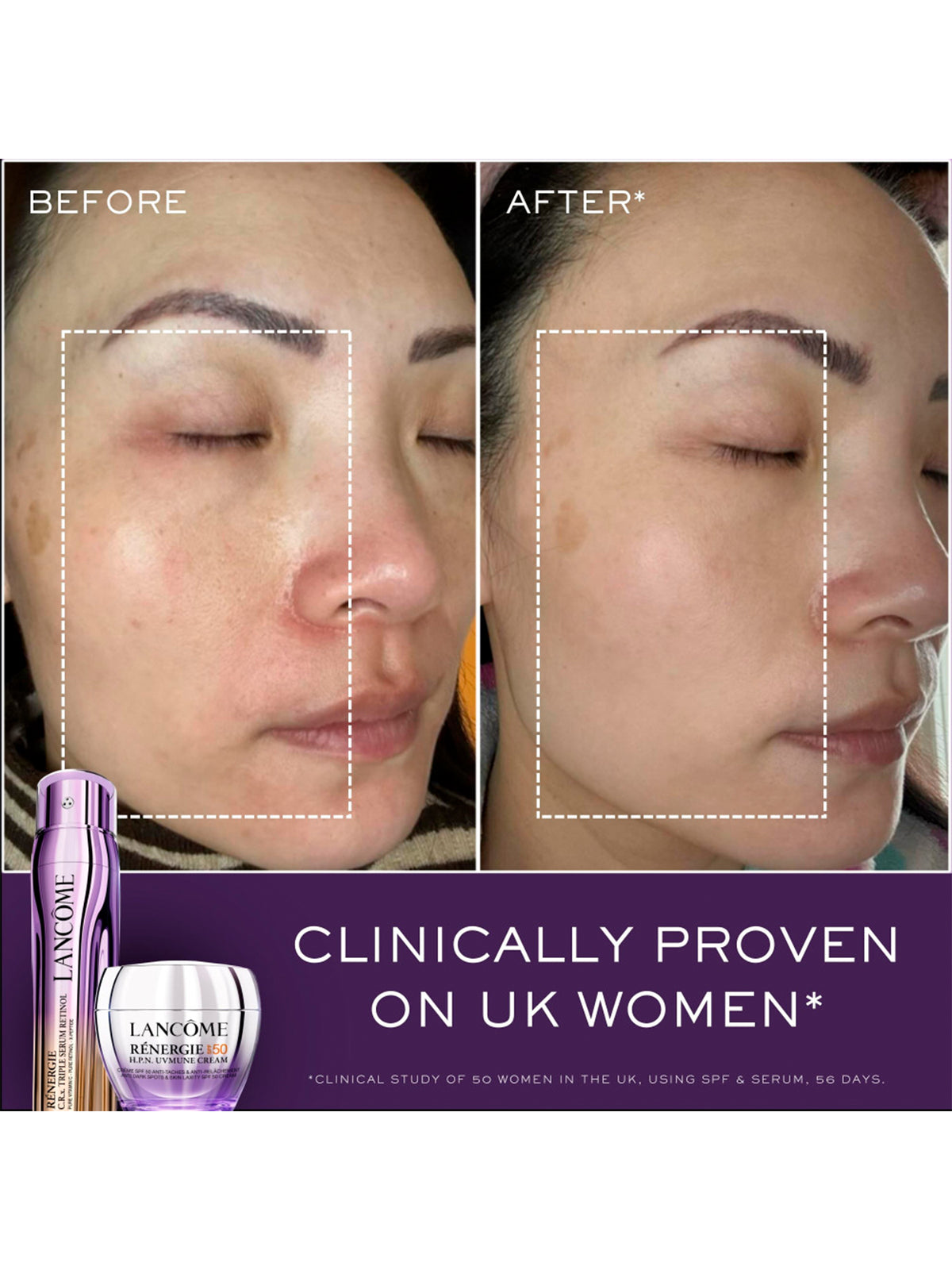 Rénergie CRX Triple Serum Retinol 50ml Set