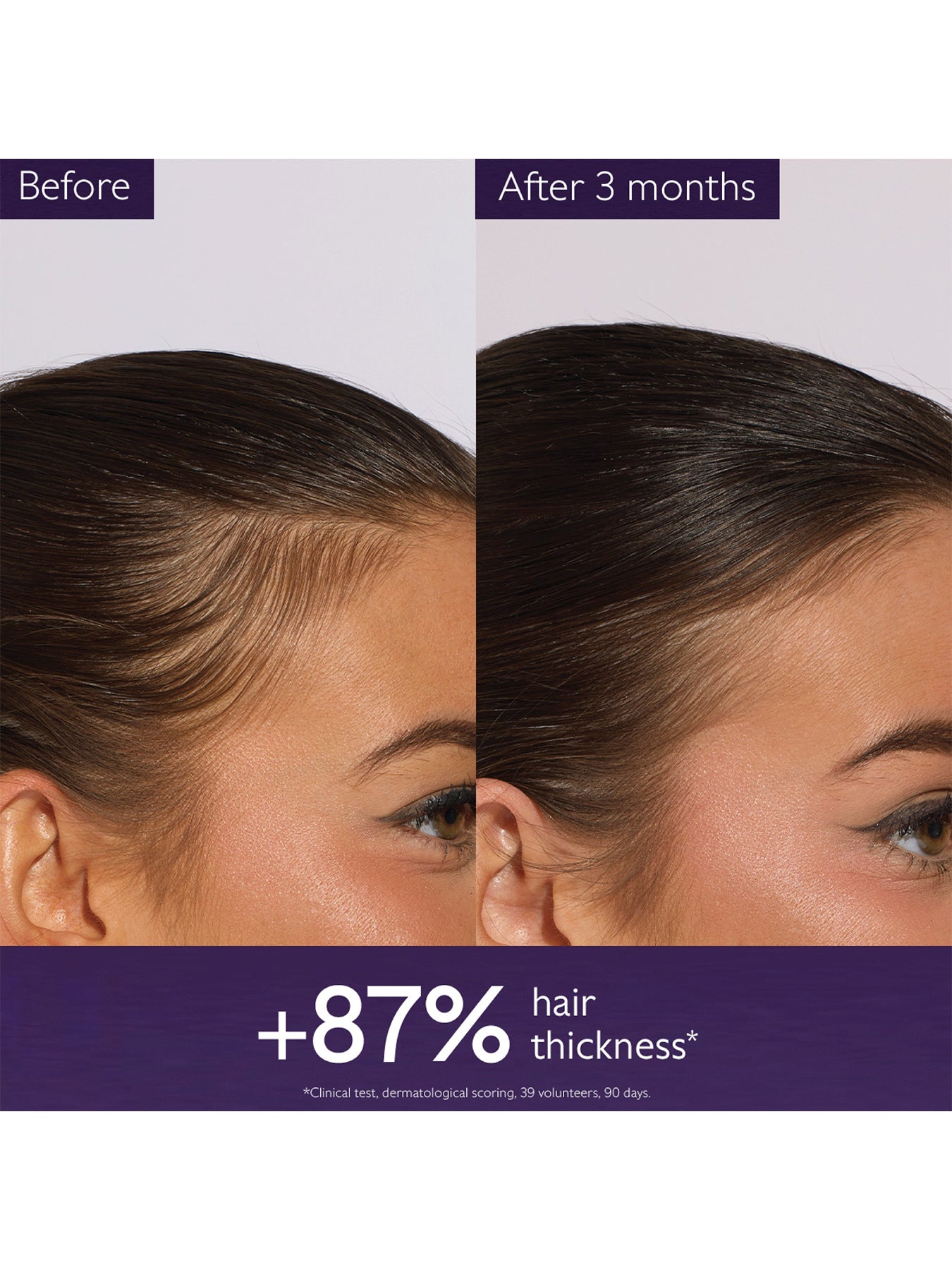 Anti Hair Loss Serum