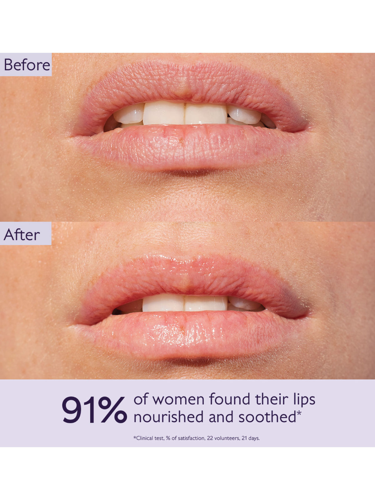Lip Balm Duo